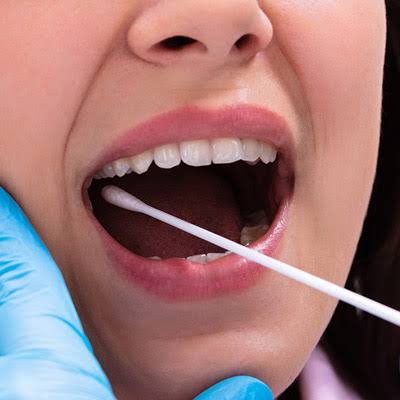 Cheek swab being taken for a confidential DNA test